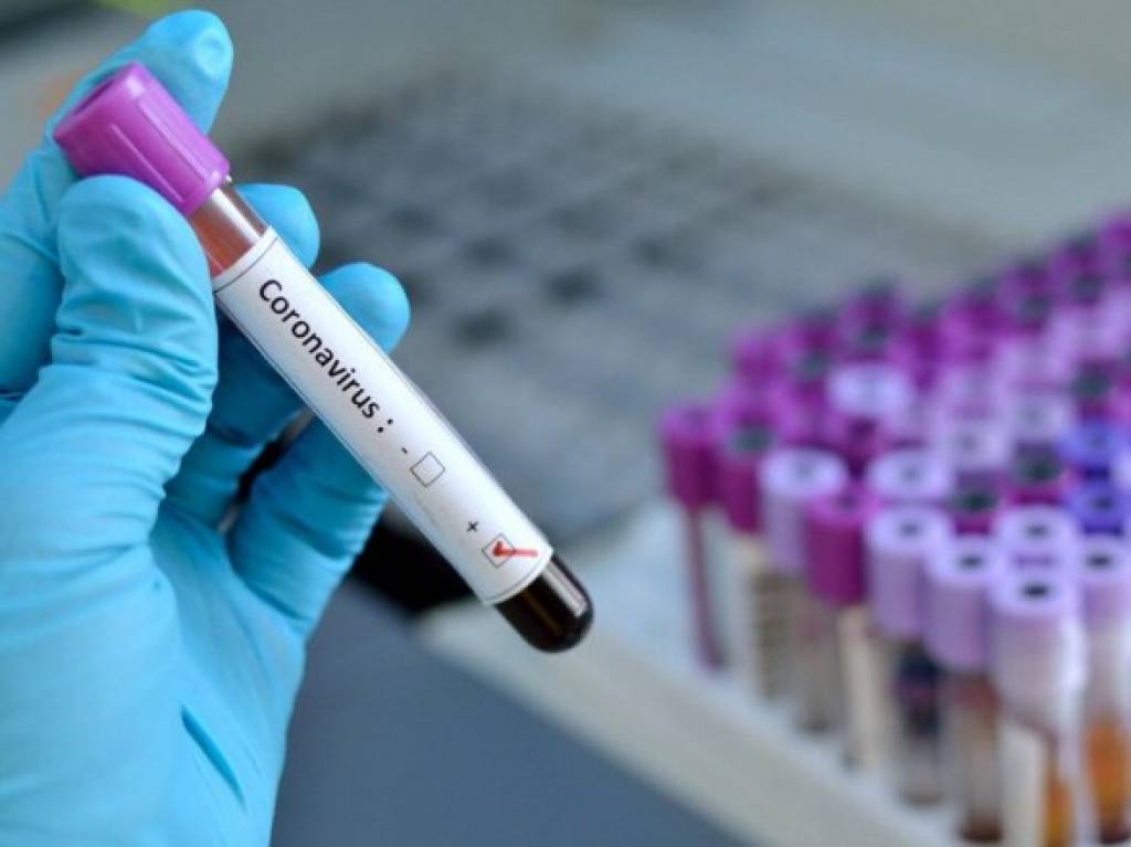 Uzbekistan’s number of confirmed coronavirus infected reaches 865