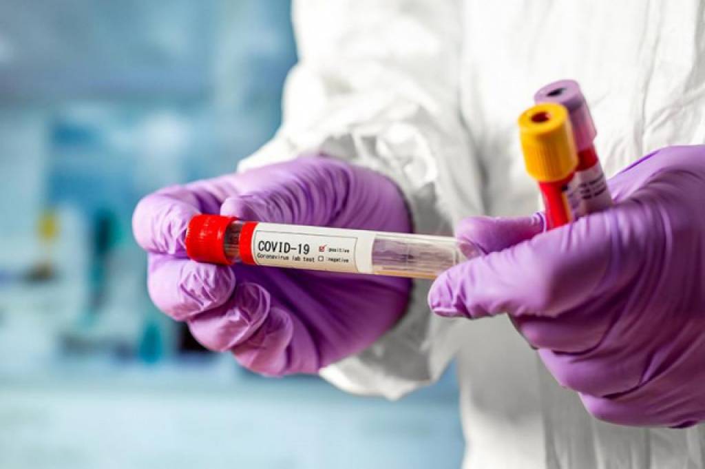 Uzbekistan’s number of confirmed coronavirus infected reaches 5561