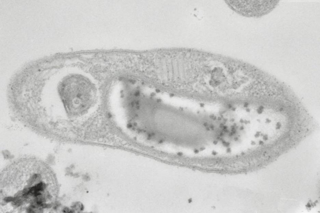 В Западной Сибири нашли новый род бактерии