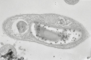 В Западной Сибири нашли новый род бактерии
