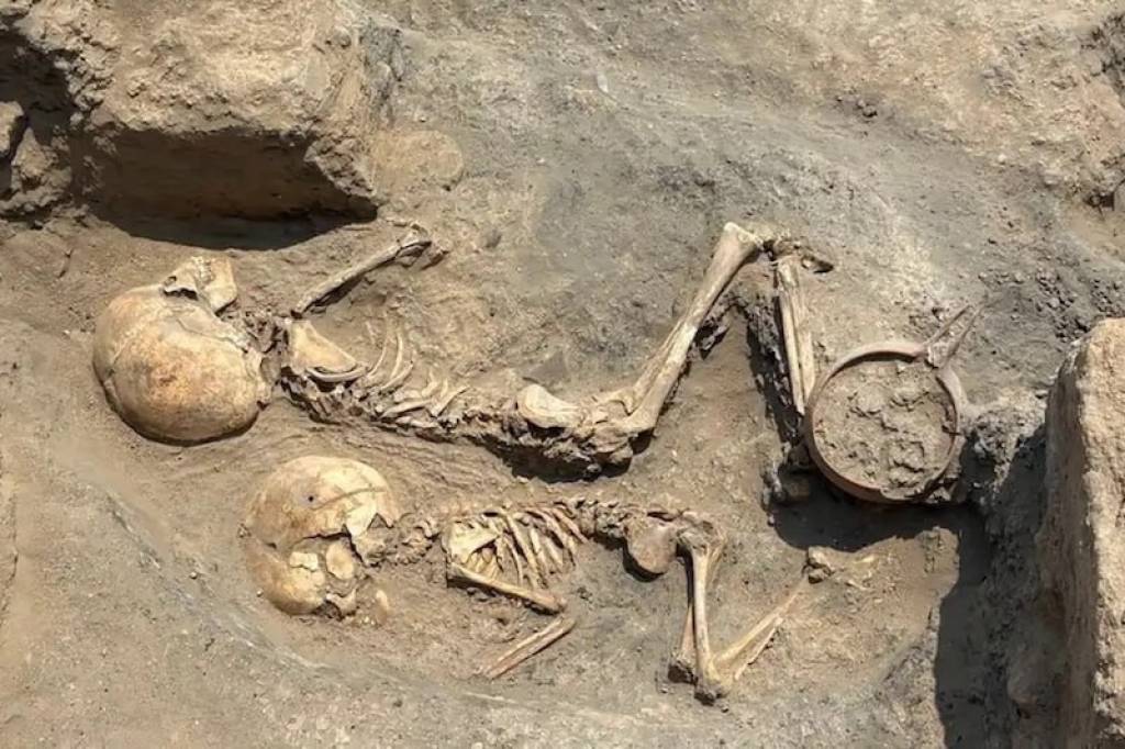O‘zbekiston hududida bronza davriga oid jarrohlik amaliyoti izlari topildi