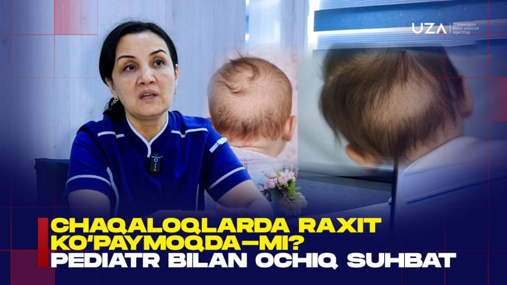 Bolaning boshi terlayaptimi? Bu raxit belgisi bo‘lishi mumkin (+video)