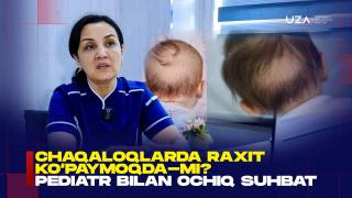 Bolaning boshi terlayaptimi? Bu raxit belgisi bo‘lishi mumkin (+video)