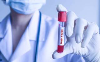 Fransiyada birinchi marta "Ebola" virusi aniqlandi